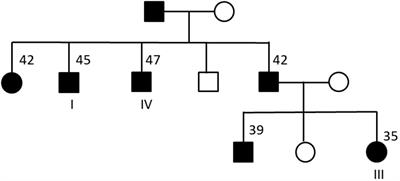 Whole-exome sequencing in familial type 2 diabetes identifies an atypical missense variant in the RyR2 gene